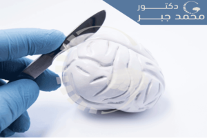 ترقيع عظام الجمجمة بتقنية ثلاثية 3D cranioplasty