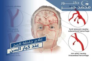 علاج جلطة المخ عند كبار السن