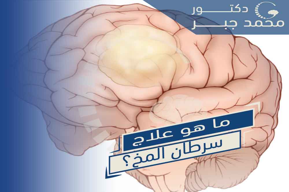 أعراض ورم المخ بالتفصيل