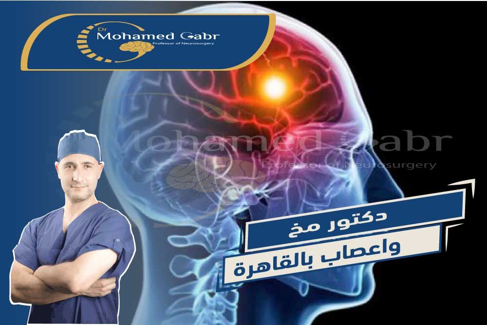 افضل دكتور مخ واعصاب في القاهرة